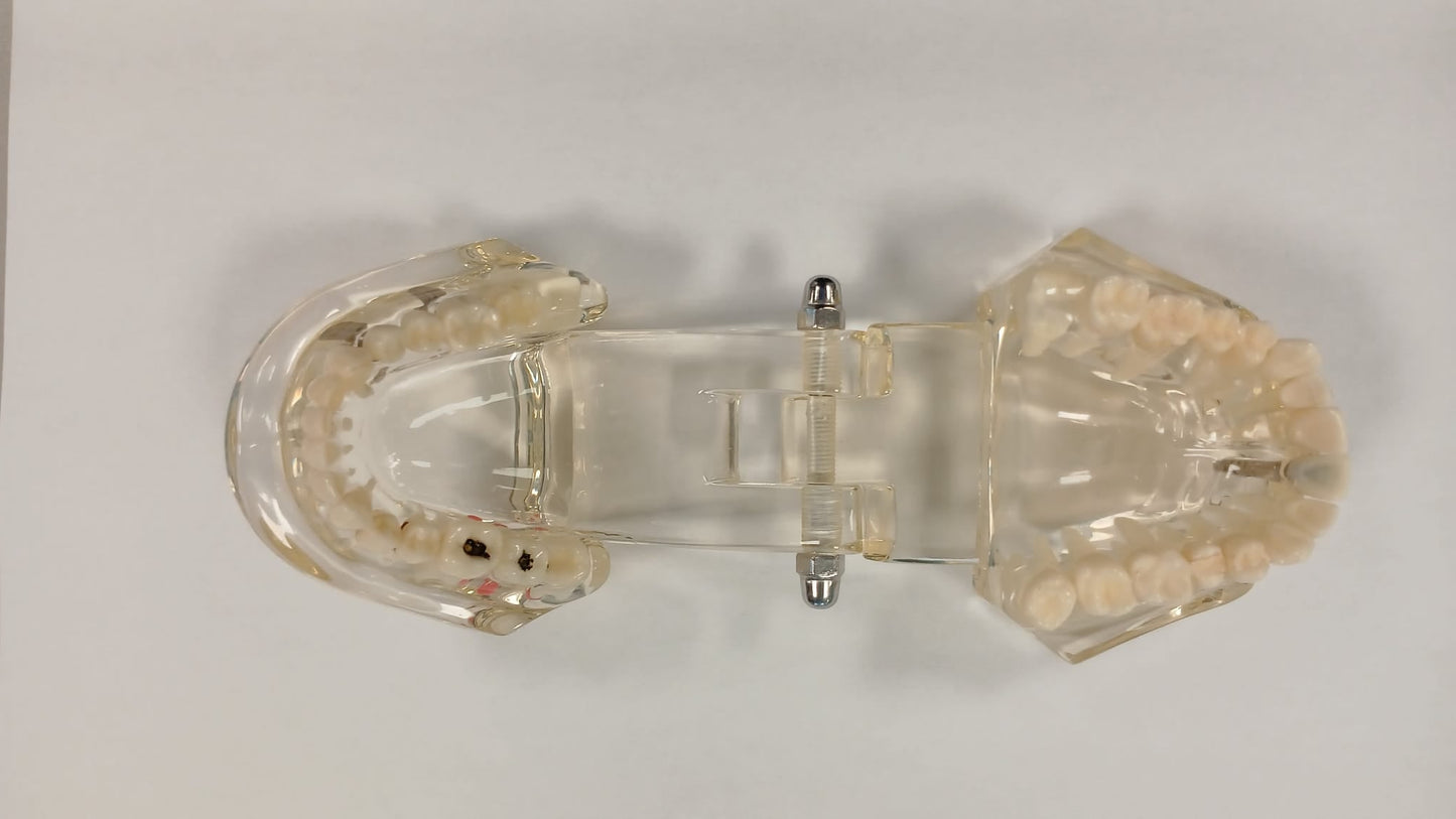 BOCCA MODELLO STUDIO MALATTIE DENTALI