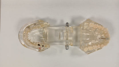 BOCCA MODELLO STUDIO MALATTIE DENTALI
