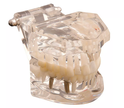 BOCCA MODELLO STUDIO MALATTIE DENTALI