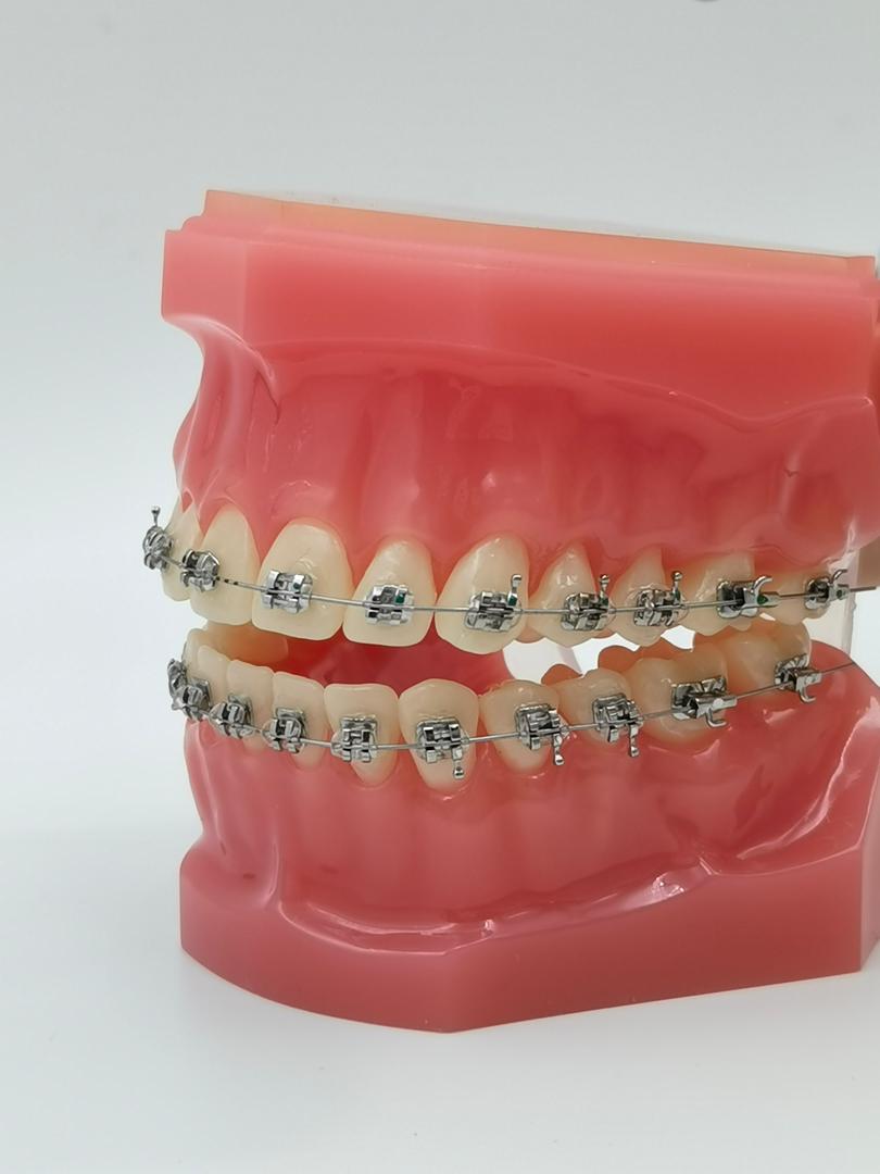 ATTACCHI BRACKETS PRAXIS PRO LANCER